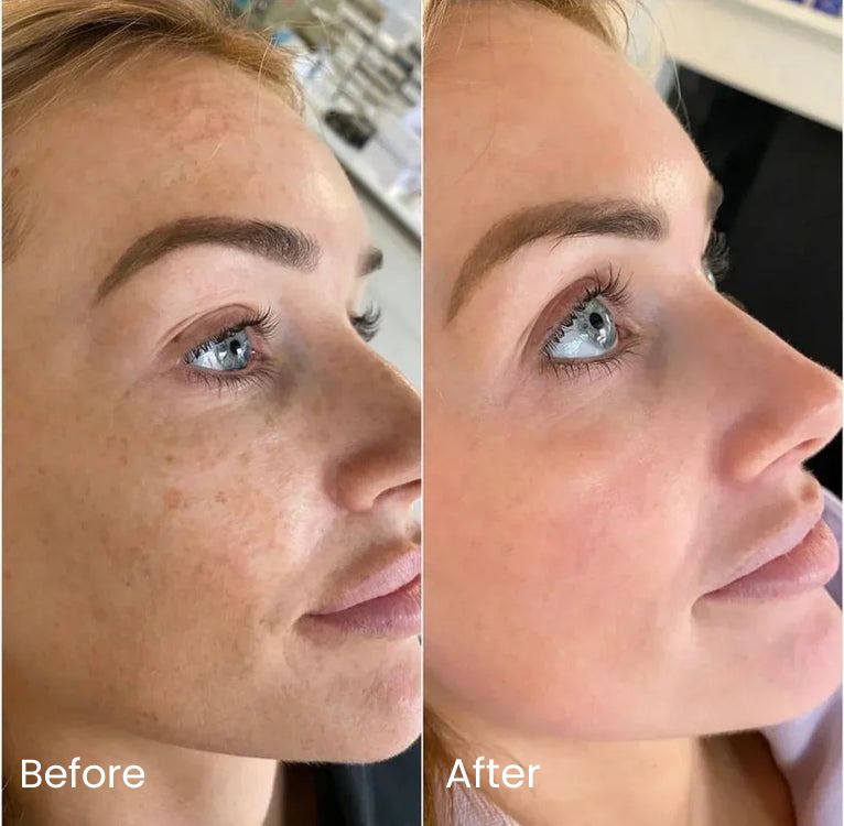 Skin Tightening Collagen Balm