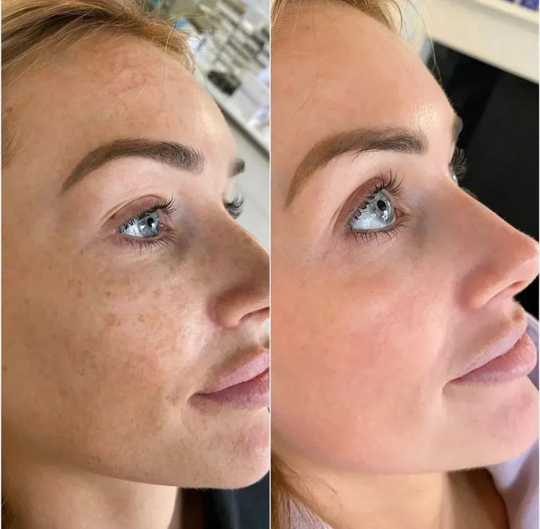 Skin Brightening Toner Pads