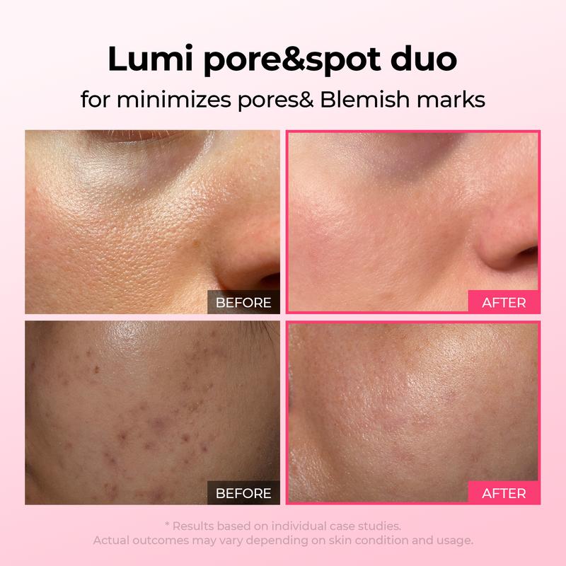 Flow+™ Pore & Spot Care Duo