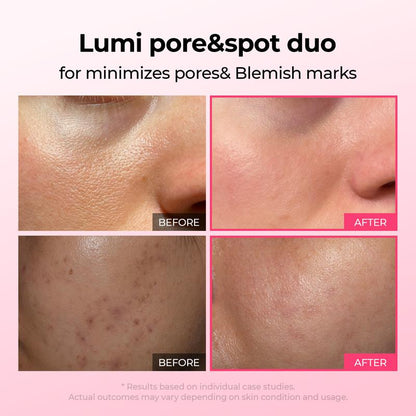 Flow+™ Pore & Spot Care Duo